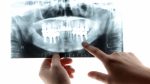 歯周病の検査について（口腔内写真、ｘ線写真編）のアイキャッチ画像