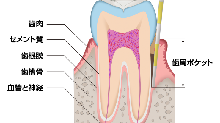 歯周病の検査について（口腔内写真、ｘ線写真編）のアイキャッチ画像