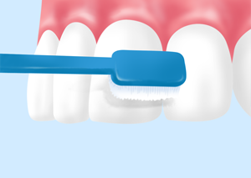 ブラッシング指導の重要性